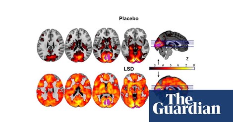 'Microdosing' mit LSD und Pilzen – neue Möglichkeiten des Drogenkonsums