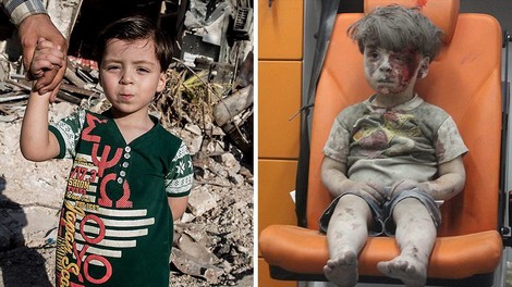 Omran aus Aleppo wurde das Gesicht des Syrien-Krieges. Das Foto hat sein Leben für immer verändert.