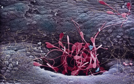 Ehrgeizige Spermien - Ein "Macho Mythos" der Biologie